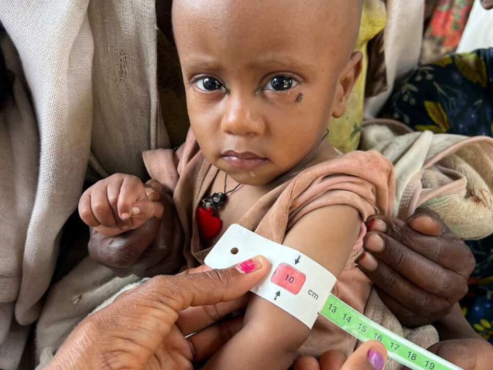 In Karamoja, Uganda, sitzt ein kleines Kind auf dem Schoß einer erwachsenen Person. Beim Messen des Oberarmumfangs zeigt das Band den Wert 10, was schwere Unterernährung bedeutet.