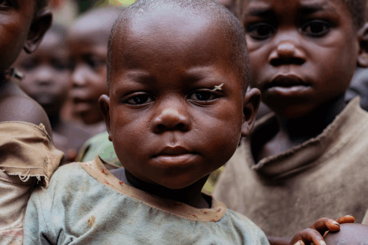 Hilfsprojekt in Burundi: Porträt eines Jungen, der stellvertretend für hungernde Kinder in Afrika steht – Spendenaktion gegen Armut und Unterernährung
