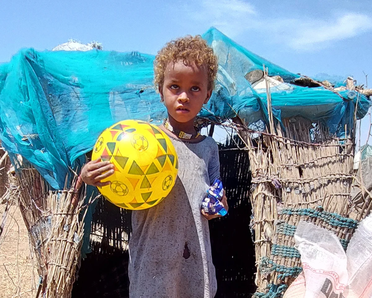 Kleines Kind in Äthiopien hält einen gelben Ball und steht vor einer provisorischen Hütte. Das Bild zeigt die schwierigen Lebensbedingungen und den Bedarf an Hungerhilfe.